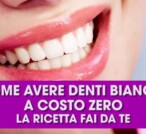 Come sbiancare i denti naturalmente a costo zero